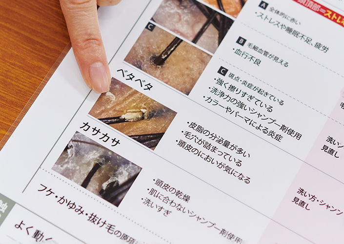 頭皮チェックシート